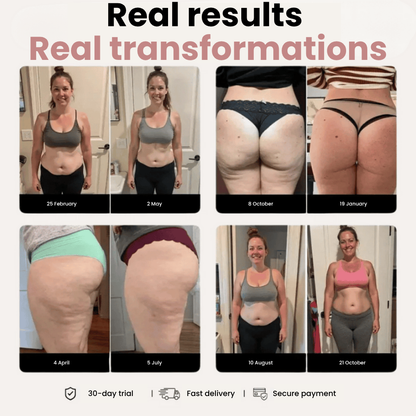 Venaria Anti-Cellulite Sculpt 3D Leggings – Look Slimmer, Smoother & Lifted in Minutes