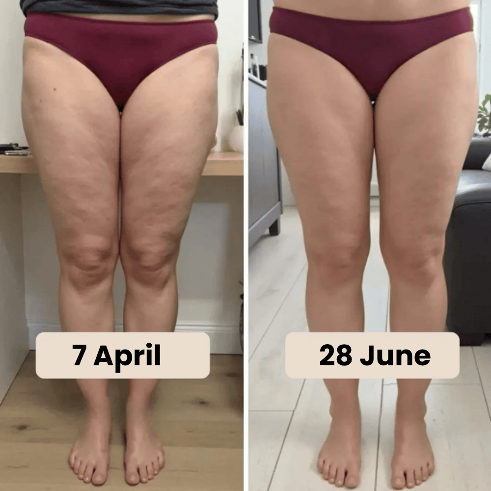 Venaria Anti-Cellulite Sculpt 3D Leggings – Look Slimmer, Smoother & Lifted in Minutes